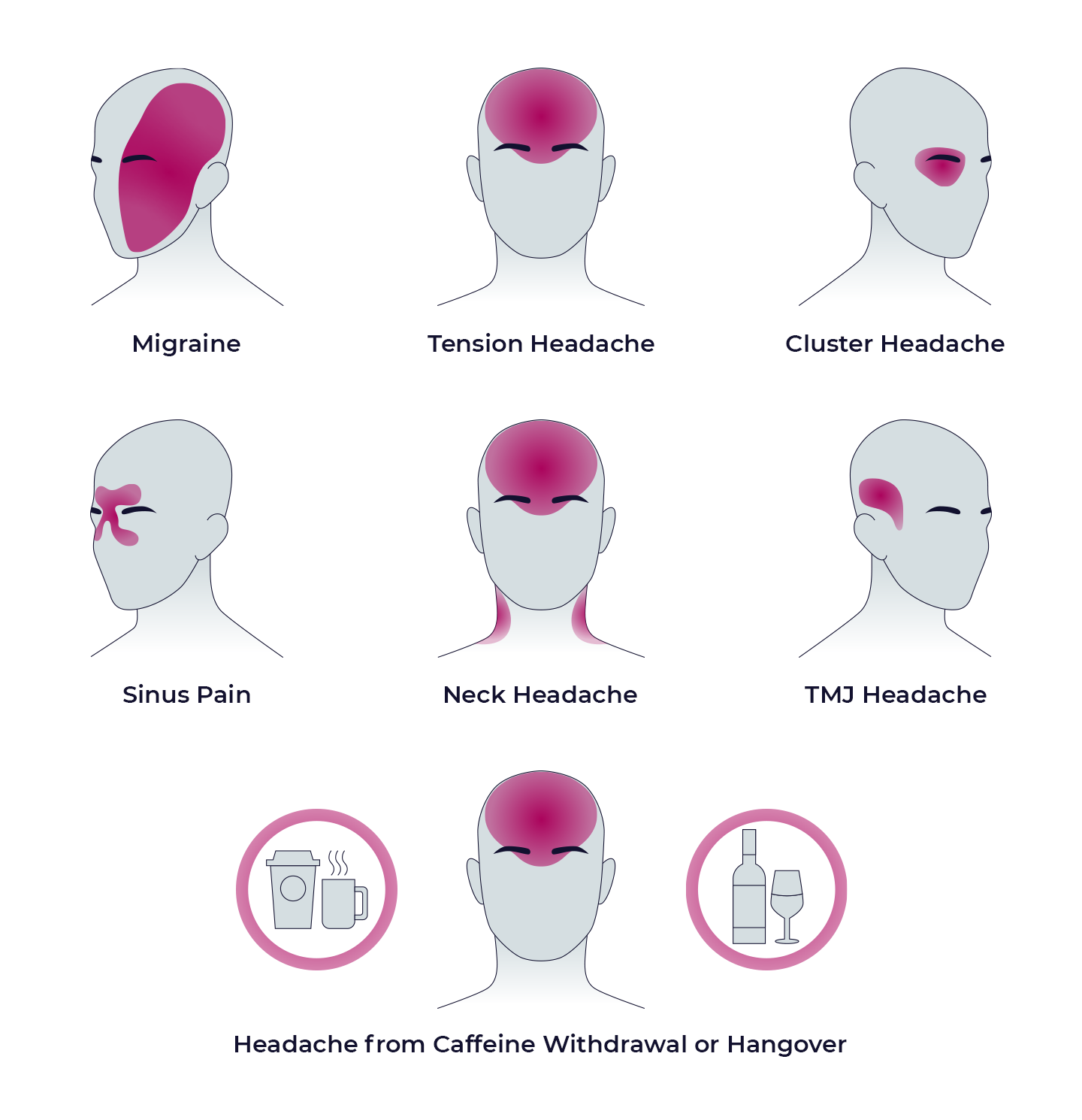 Migraine Relief Gel Cap – Hot & Cold Therapy for Headaches, Stress & Sinus Pain