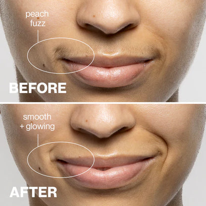 GlowPro Your Next Hair Removal Kit