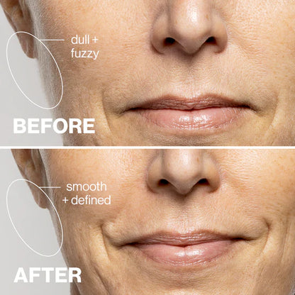 GlowPro Your Next Hair Removal Kit