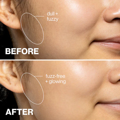 GlowPro Your Next Hair Removal Kit