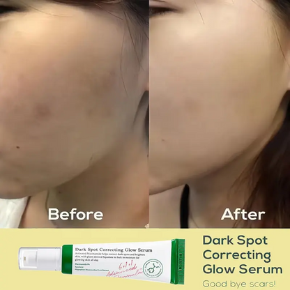 Dark Spot Correcting Glow Serum 50ml - Anti-Aging & Skin Brightening Formula for Radiant Skin